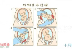 如何让胎儿快速发动（38周了如何让胎儿快速发动）
