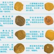怀孕后大便次数多怎么回事,孕期排便次数多正常吗