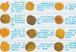 怀孕后大便次数多怎么回事,孕期排便次数多正常吗