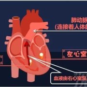 孕期肺动脉高压（孕期肺动脉高压是什么引起的）
