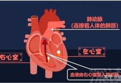 孕期肺动脉高压（孕期肺动脉高压是什么引起的）
