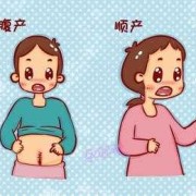 孕36周，发现胎儿头朝下面朝外，能否顺产？还是剖腹产,胎儿 面朝外