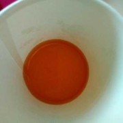 怀孕期尿液发红（怀孕期间尿发红）
