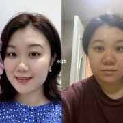 为什么怀孕鼻子会变大,孕期鼻子变大能恢复吗图片