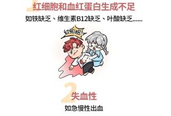 孕期地中海贫血的症状（孕期地中海贫血的症状表现）