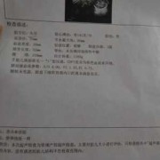 胎儿颈后见u型压迹是什么意思,胎儿u型压迹是什么意思