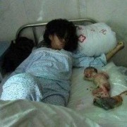 怀孕期间总是梦见自己流产了，是怎么回事呢,梦见流产出来的小胎儿还在一直动