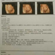 25周的胎儿有多重（25周多了，四维彩超说NF增厚是什么意思）