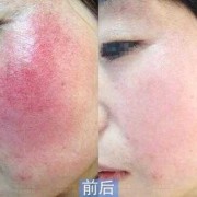 怀孕四个月了流一点血丝是怎么回事,孕期红血丝分泌