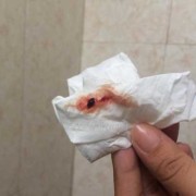 怀孕两个半月，检查尿酮体是2+，请问对胎儿有影响吗?该怎么办,怀孕酮体高对胎儿影响有哪些