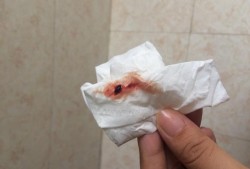 怀孕两个半月，检查尿酮体是2+，请问对胎儿有影响吗?该怎么办,怀孕酮体高对胎儿影响有哪些