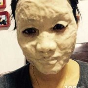 敷面膜会影响胎儿吗（孕妇可以天天敷鸡蛋面膜吗）