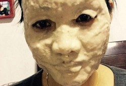 敷面膜会影响胎儿吗（孕妇可以天天敷鸡蛋面膜吗）