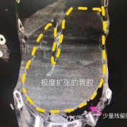 胎儿胃扩张（胎儿胃扩张）