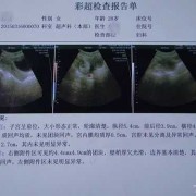 孕32周，彩超发现胎儿腹部有一个5×4.5的囊性团块，怎么办啊,孕32周胎儿彩超指标