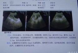 孕32周，彩超发现胎儿腹部有一个5×4.5的囊性团块，怎么办啊,孕32周胎儿彩超指标
