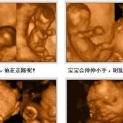 孕妇产检期间需要做几次四维彩超,整个孕期要做几次四维彩超