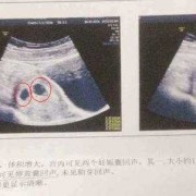 孕6周的胎儿多大才是正常,怀孕六周胎儿图看男女准吗