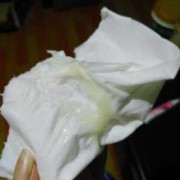 易孕期白带多（怀孕7周多白带多是正常的吗）