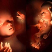 孕13周的胎儿和图片（13周孕妇标准的肚子图）