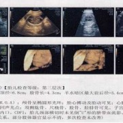 怀孕7个月可以做四维彩超吗,胎儿七个月四维彩超图