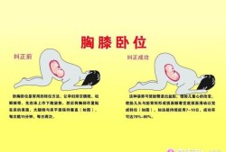胎儿臀围（胎位臂位是什么意思）