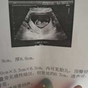 10周胎儿图片（已怀孕10周，还是没有尿频现象，正常吗）