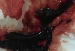 孕期流红色血（孕妇白带带一点点血丝是见红了要生的情况吗）