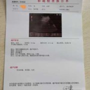 胎儿心跳165正常吗（胎儿心跳165正常吗）