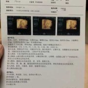 怀孕第8周有一点点褐色的分泌物，要紧吗,怀孕8周胎儿稳定了吗 有胎心了吗