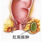 孕期肛门长肉疙瘩（孕期肛门长肉疙瘩会自己恢复吗）