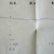 孕妇尿液检查酮体高是怎么回事,孕期尿酮体高说明什么问题呢