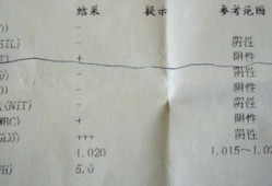 孕妇尿液检查酮体高是怎么回事,孕期尿酮体高说明什么问题呢
