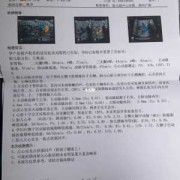 胎儿心脏彩（胎儿心脏彩超最佳时间）