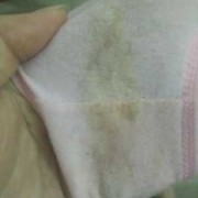 孕期内裤很脏（孕期内裤很脏正常吗）