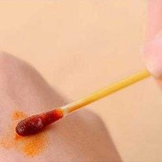 孕晚期阴部肿胀疼痛怎么办,孕期下体肿痛可以用碘伏消毒吗