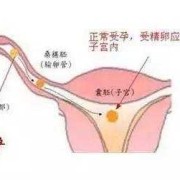 孕期右下腹部隐痛的原因（孕期右下腹部隐痛的原因有哪些）