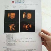孕期彩超需要空腹吗（彩超不能吃东西吗）