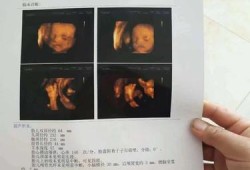 孕期彩超需要空腹吗（彩超不能吃东西吗）