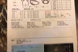胎儿偏大原因（胎儿偏大原因造成的）