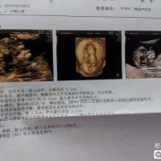 颈后透明层厚度多大正常,胎儿颈项透明层厚度正常值