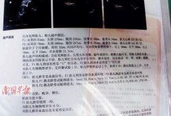 孕期27周，B超显示单脐动脉，小孩能要吗,单脐动脉的胎儿生下来会畸形吗