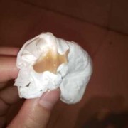 孕期流水（孕期流水状液体是什么）