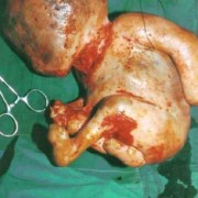人死后有哪些特征,胎儿死胎的症状及征兆