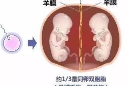 胎儿带羊膜（双胞胎胎儿之间有隔膜）