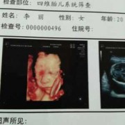 四维检查结果正常，但是宝宝脸上有东西是什么,四维图片胎儿全图