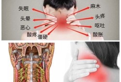 孕期颈椎（孕期颈椎疼痛难忍怎么办）