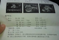 医生说胎头高是什么意思？胎头高胎头高胎头高,胎儿头浮图片
