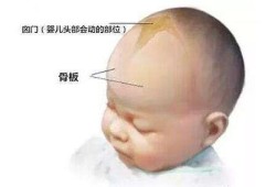 胎儿脑积水的原因（宝宝外部脑积水怎么办，给宝宝怎样治疗好呢）