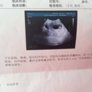 孕20周b超查男女准吗？一般怀孕什么时候做b超,b超检查胎儿性别准吗